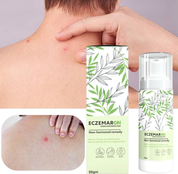 yumora Eczemaron Anti Fungal Cream For Men, & Women,
