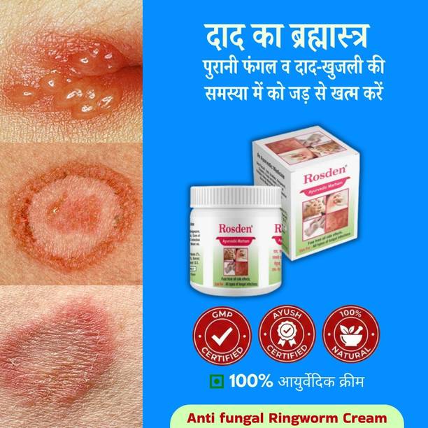 Rosden Ayurvedic Malam 25g – Daad Khaj Khujli Relief Antifungal Cream