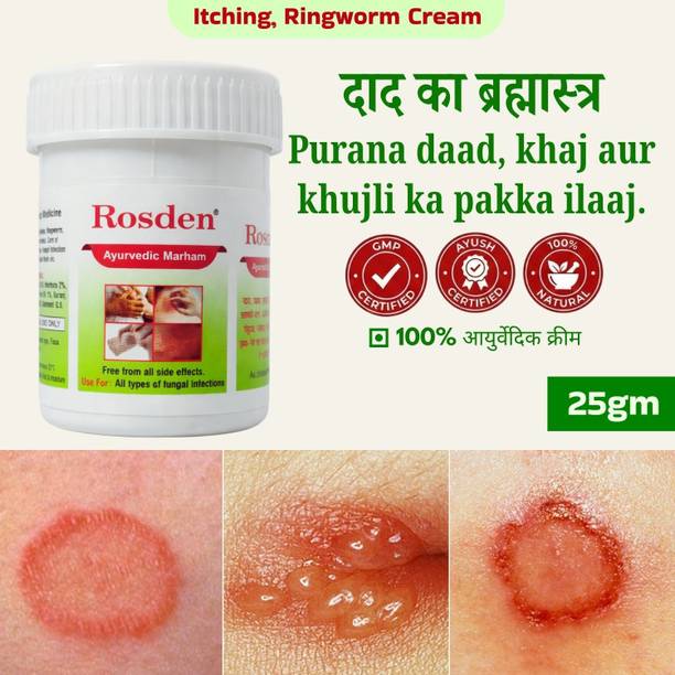 Rosden Ayurvedic Khaj Khujli Cream 25g – Ringworm Relief