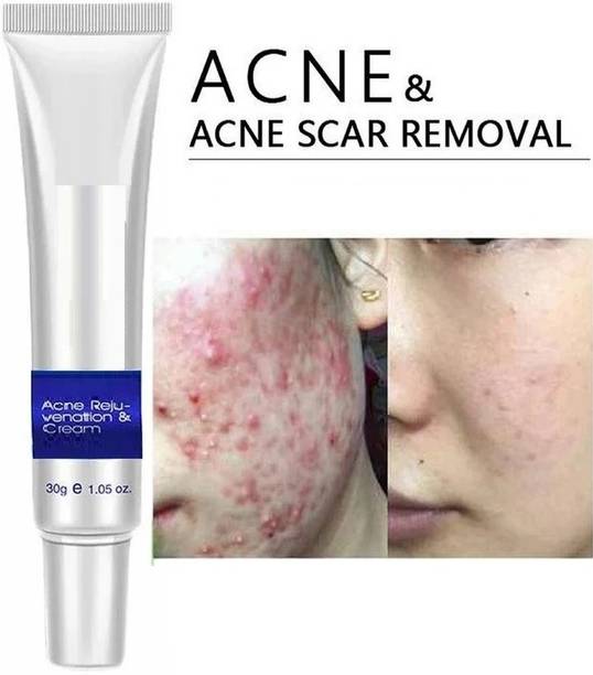 manasona Dark Spot Remover Cream For Remove Pimple Marks, Acne Scar Blemishes