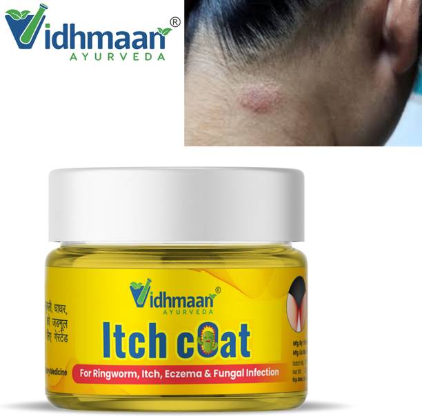 vidhmaan ayurveda Itch Coat Skin Fungal Infections Malam Ringworm, Itching,Skin Cream
