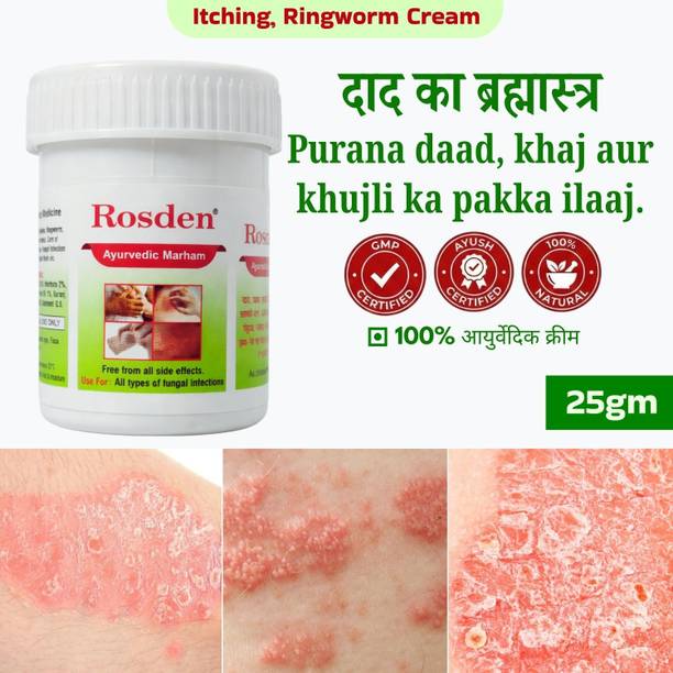Rosden Antifungal Skin Cream 25g – Ayurvedic Daad Khaj