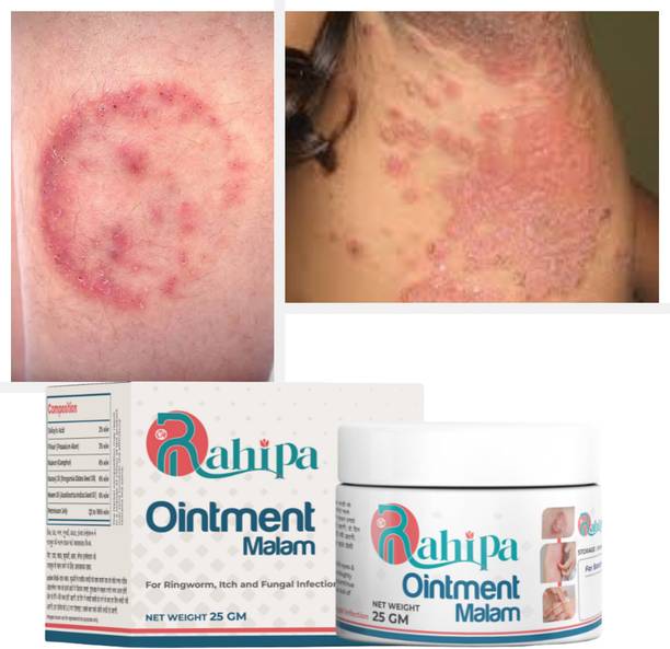 RAHIPA Natural Ayurvedic Anti-Fungal Malam - Soothes Itching, Heals Ringworm & Eczema