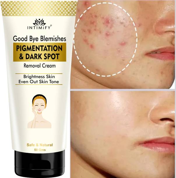 INTIMIFY Good Bye Blemishes Face Cream, For Pigmentation & Blemish Removal