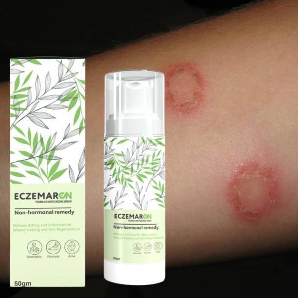 Eczemaron Fungal Cream For Men & Women Ayurvedic ItchCoat Anti fungal Malam for Ringworm itching spary