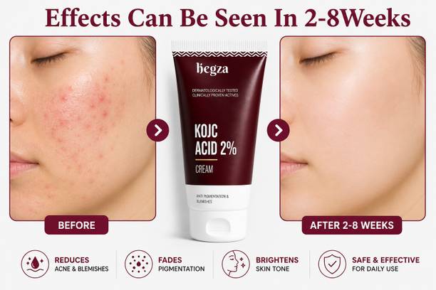 Hegza Anti Pigment Skin Cream Dark Spot Removal Cream for Pigmentation, Dull Skin & Wrinkles| Brightening Face Cream