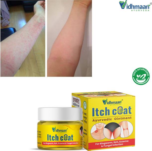 vidhmaan ayurveda Ayurvedic ITCHCOAT Antifungal Malam Ringworm,Eczema , Fungal Infection & itching , Dhadhar malam - Ringworm Cream