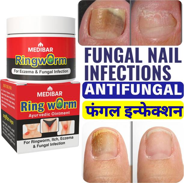 medibar Antifungal Cream Nail - Fast Action Formula For Fungal & Ringworm Care , Best Ringworm Cream ( Pack of -1)_