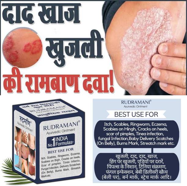 Rudramani Eczemaron Ringworm antifungal Cream (1)