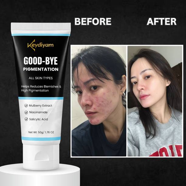 keydiyam GOOD BYE GlowFix Pigment Solution