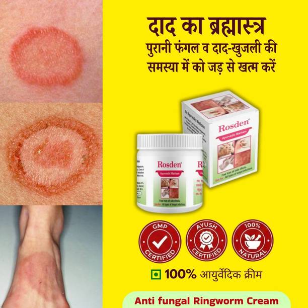 Rosden Ayurvedic Daad Khaj Cream 25g – Itching, Ringworm Relief