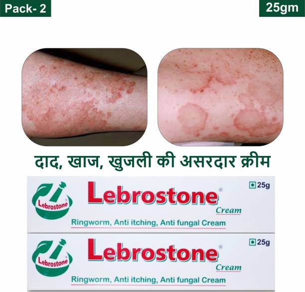 Lebrostone Ayurvedic Skin Care Treatment Cream 25g – For Ringworm, Itching & Fungal Infections (Pack of 2)