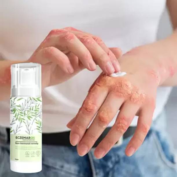 Dr. DAHAO Herbal Eczemaron Anti Fungal Cream For Men & Women