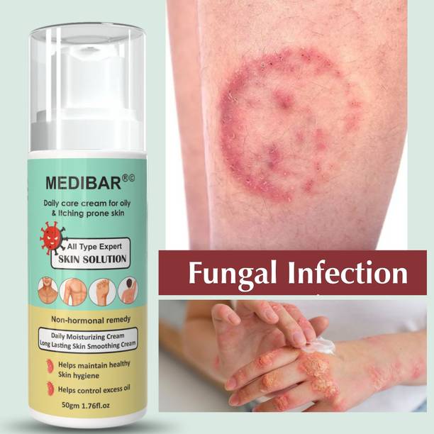 medibar Eczema anti fungal cream non hormonal Remedy ,Antifungal Cream for Fungal Infection Solution Pack of -1