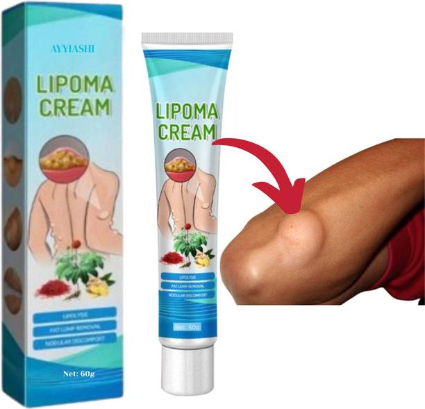 SIYDHA Herbal Lipoma Removal Cream Best For Lumps And Bumps