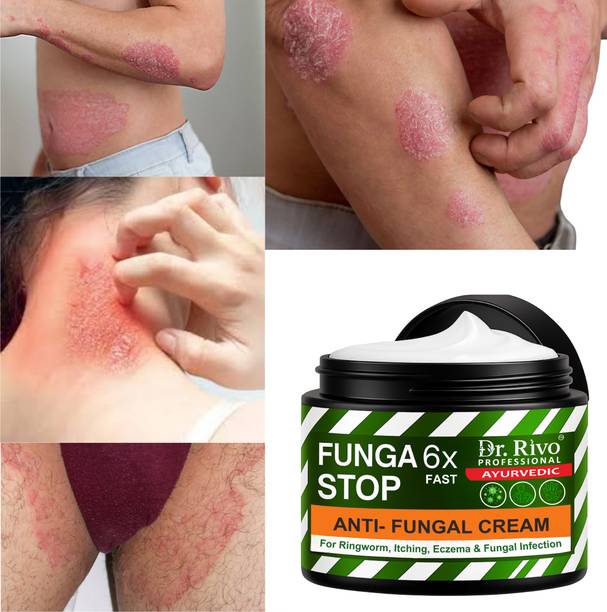 Dr.Rivo PROFESSIONAL Ayurvedic -Anti fungal Malam- for Ringworm, Itching, Eczema & Fungal Infection