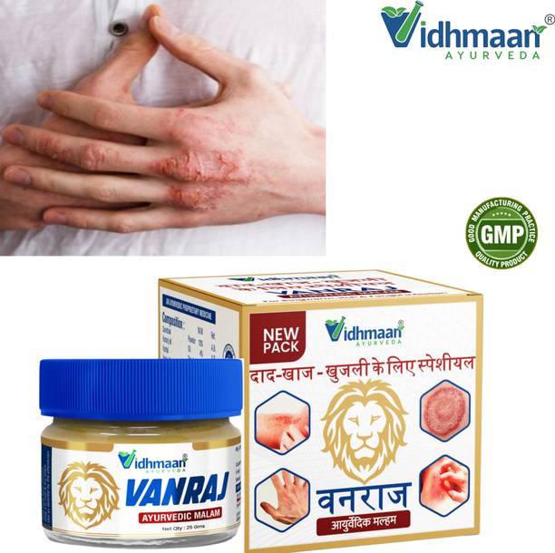 vidhmaan ayurveda Vanraj Ayurvedic Skin Balm – Safe & Effective Fungal Treatment