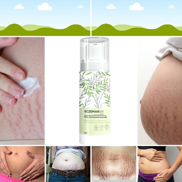 Eczemaron Ringworm Vitamin C + E Sorbet Super Bright Moisturizer For Face Reduces Skin Dullness