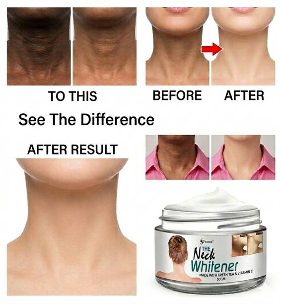femoz Cream For Dark Neck, Ankles, Knuckles, Elbows, Underarm Whitening Cream
