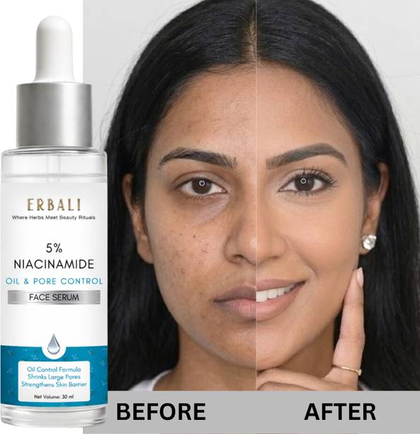 Erbali 5% Niacinamide Face Serum for Oily Skin | Controls Sebum, Reduces Pores & Fades Dark Spots