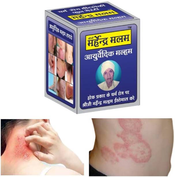 Shreeji Marhendra Anti-Aging Fungal Malam For Dad Khaj Khujali, itching Cream, Ringworm, Eczema !