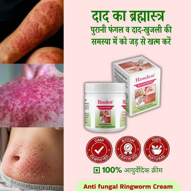 Rosden Daad Khaj Malam 25g – Ayurvedic Antifungal & Itch Relief