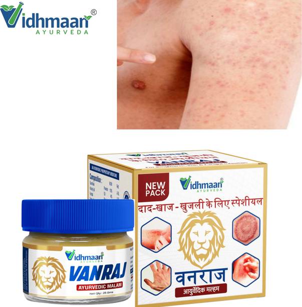 vidhmaan ayurveda Vanraj Ayurvedic Malam – Ayurvedic Anti‑Fungal for All Skin Types