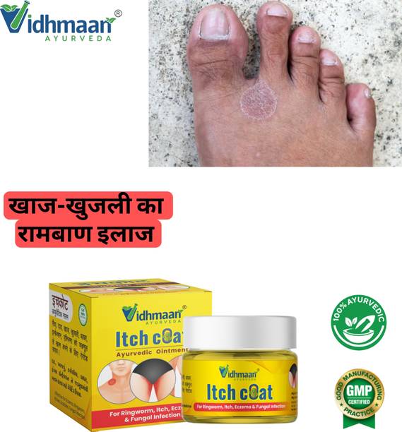 vidhmaan ayurveda Itch coat Anti fungal Malam - for Ringworm, itching, Eczema,Burn Mark, Foot Care cream (Pack of 1)