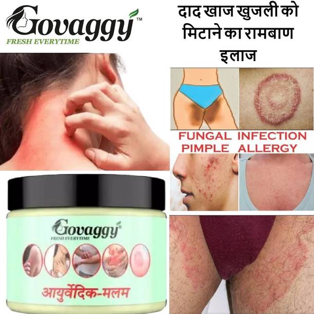 Govaggy Ayurvedic Anti Fungal Malam for Ringworm, itching, Eczema & Fungal Infection