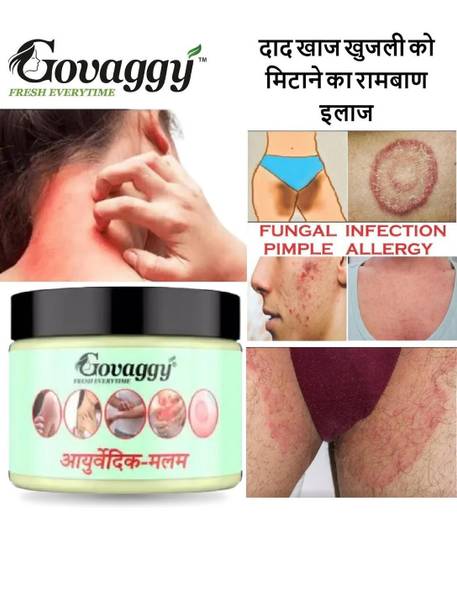 Govaggy Ayurvedic Anti Fungal Malam for Ringworm, itching, Eczema & Fungal Infection