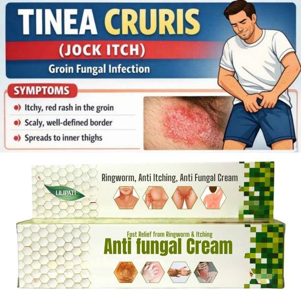 LILIPATI Anti Fungal Cream for Men & Women – Daad Khaj Khujli, Ringworm & Itching Relief Cream