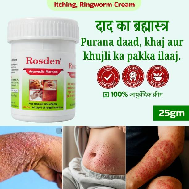 Rosden Ayurvedic Skin Fungus Cream 25g – Khujli Relief
