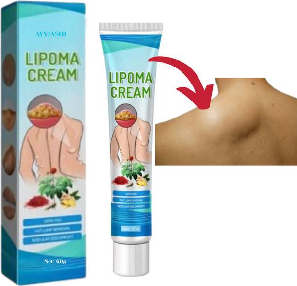 SIYDHA Lipoma Treatment Kit Herbal For Safe Gaanth Removal