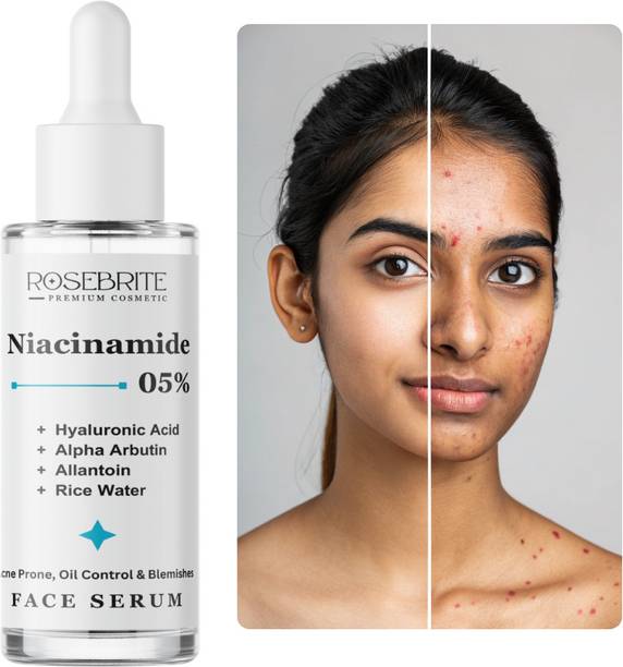 RoseBrite Luxury Radiance Salicylic Acid Serum with Hyaluronic Acid, Ferulic Acid, Allantoin & Licorice for Dark Spots, Bumps & Youthful Glow