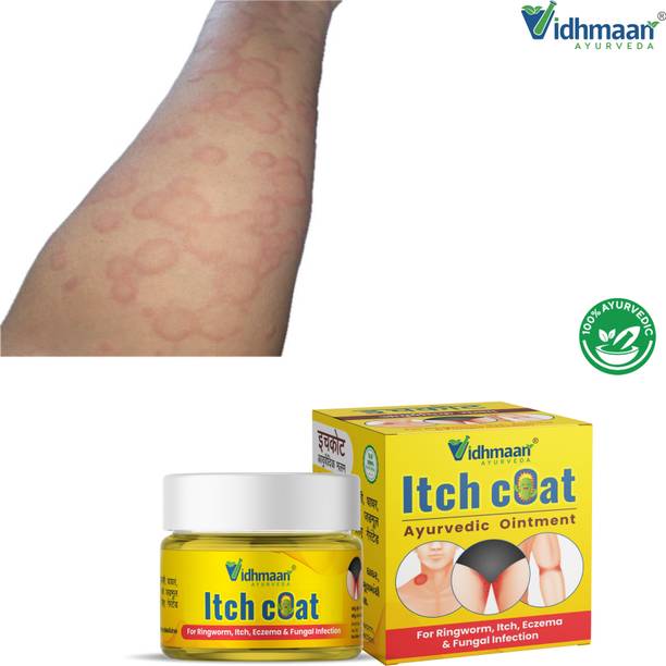 vidhmaan ayurveda ItchCoat -Anti fungal Malam- for Ringworm,Eczema&Fungal Infection problem