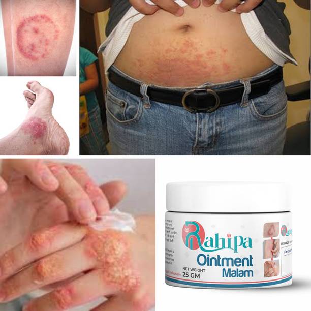 RAHIPA Anti Fungal Skin Infection Cream for Ringworm, Eczema, Itching, Dad Khaj Khujli Relief | Ayurvedic Skin Repair Ointment Malam for Men & Women | 25g..