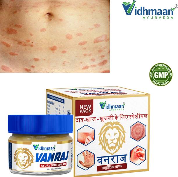 vidhmaan ayurveda Vanraj – Fast Relief Itch & Skin Infection