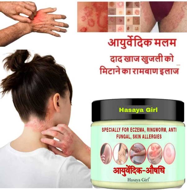 HGHASAYAGIRL Ayurvedic Anti fungal Malam for Ringworm, itching, Fungal Infection & Eczema result in 23 days