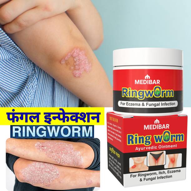 medibar Ayurvedic Skin Care Treatment Cream 30g – For Ringworm, Itching & Fungal Infections (Pack of 1)