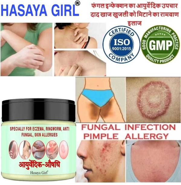 HGHASAYAGIRL Ayurvedic Anti fungal Malam for Ringworm, itching, Fungal Infection and Eczema