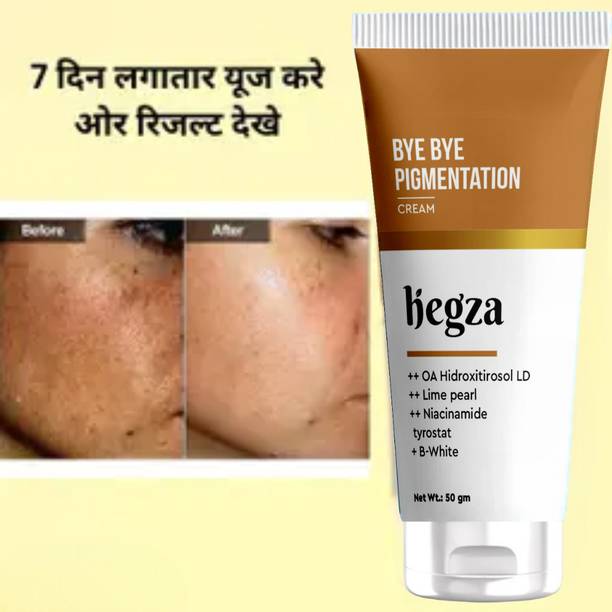 Hegza Dark Spot Corrector Cream | Bye Bye Pigmentation | Suitable for All Skin Types