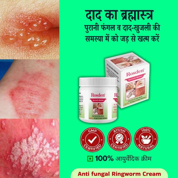 Rosden Ayurvedic Malam 25g – Daad Khaj Itching Cream, ringworm & Antifungal Cream