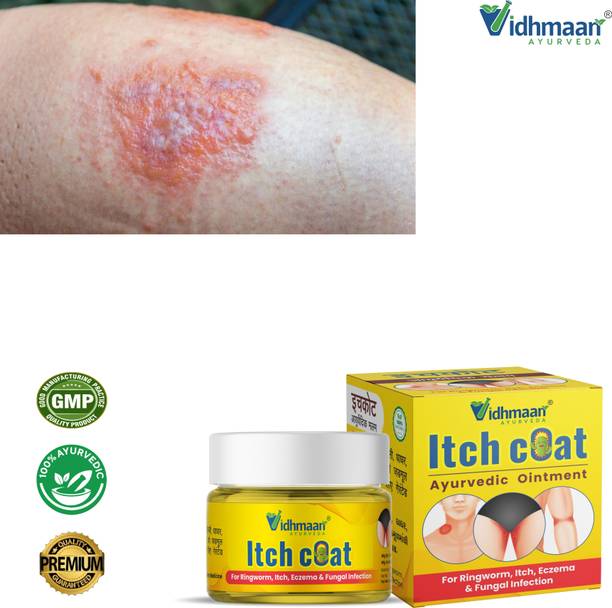 vidhmaan ayurveda ItchCoat-Fungal Infection Malam -for-Ringworm-Eczema crem for skin care