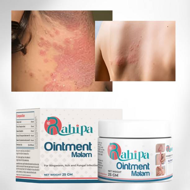RAHIPA Eczema Cream,Ringworm Cream,Itching Cream,Daad Khaj Khujli Malam...01