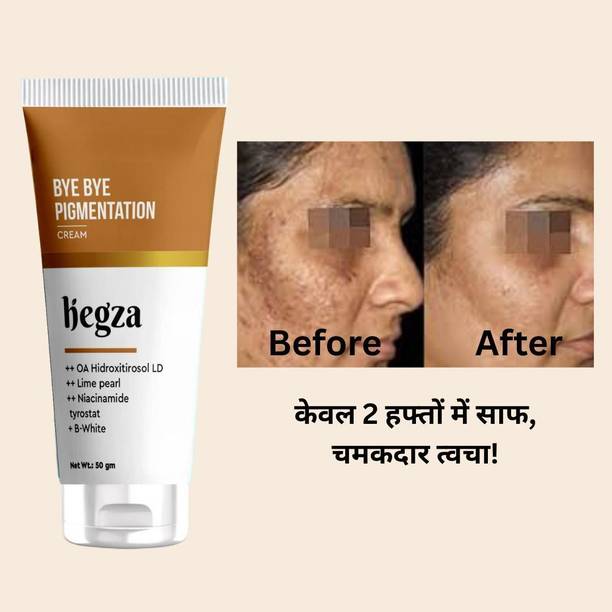 Hegza Bye Bye Pigmentation Cream for Dark Spots & Uneven Skin Tone – Daily Brightening Formula