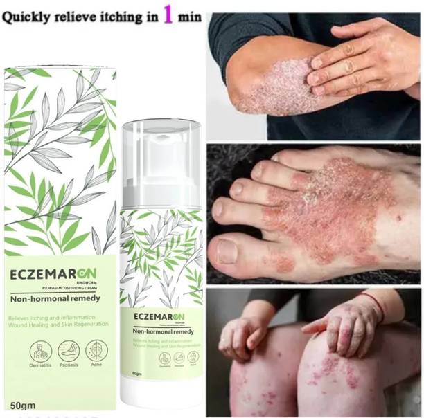 Rudramani Eczema Ringworms Anti fungals Cream for Ringworm, itching Cream, Eczema & Skin Infection, Skin Tretment, Skin Moisturizer Cream For Men And Women