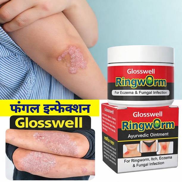 glosswell Powerful Herbal Antifungal Cream for Skin Infection and Itch Relief