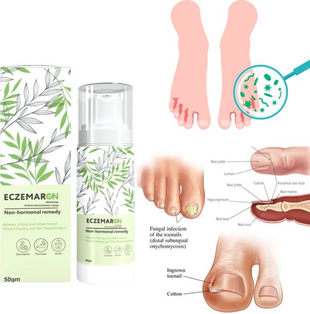 Eczemaron Ringworm Nail Repair And Fungal Removal , Nail Fungal Cream