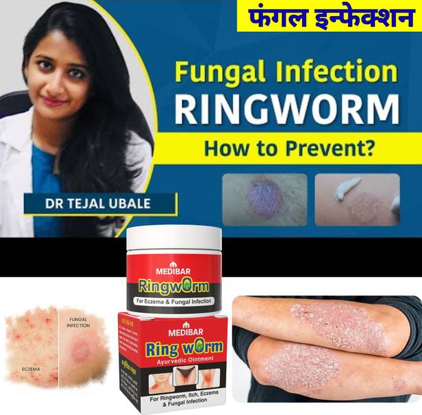 medibar Ayurvedic Malam Cream for Anti-Fungal Infection,Itching & Skin Recovery _PACK-01-