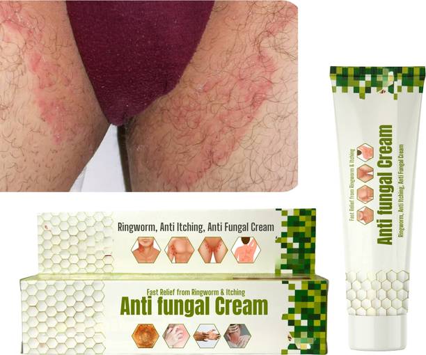 LILIPATI Anti Fungal Cream for Daad Khaj Khujli, Ringworm & Skin Infection Relief | Ayurvedic Itching Cream